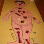operation